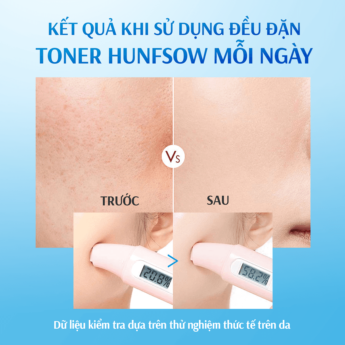 Toner Dưỡng Ẩm Da 96:4 Hunfsow - Hình 6